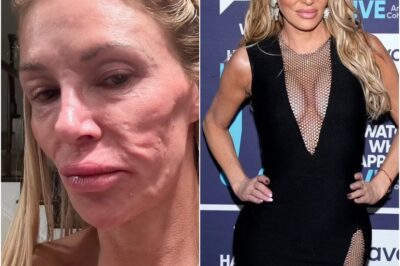 FROM PARASITES TO PLASTIC SURGERY: Brandi Glanville’s SHOCKING Confession – The Eye-Watering Sum She’s Dropped to ‘Fix’ Her Face