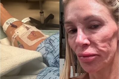 PARASITE NIGHTMARE! Reality Star’s Face Under ATTACK as Emergency Crews Rush to Save Her