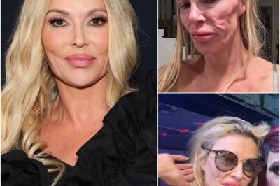 Brandi Glanville Breaks Her Silence: ‘I’ve Been Hiding’ After Vicious Online Attacks on Her Disfigured Face—Exclusive Interview Reveals Her Emotional Struggle, the Cruel Comments That Drove Her Into Seclusion, and How She’s Fighting Back Against the Hate!
