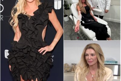 Brandi Glanville’s $100K Face Makeover Revealed—Fans Stunned by Her Extreme Transformation After Disfigurement Drama!