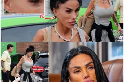 Tour Tragedy? Katie Price Debuts Alarming Weight Loss and Painful Eye Injury on Stage with Kerry Katona—Fans Horrified by Star’s Frail Appearance and Question If She’s Fit to Continue!